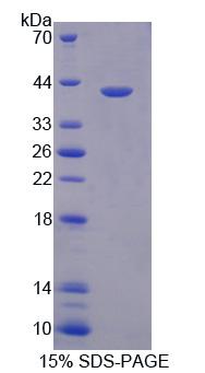 Recombinant Heat Shock Protein 90kDa Alpha B1 (HSP90aB1)