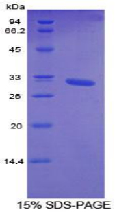 Recombinant Cytochrome P450 26A1 (CYP26A1)