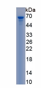 Recombinant Cytochrome P450 11B1 (CYP11B1)