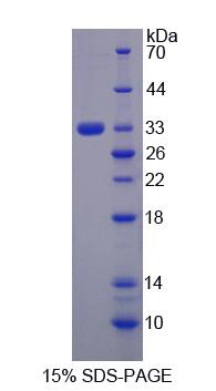 Recombinant Mitogen Activated Protein Kinase Kinase Kinase 6 (MAP3K6)