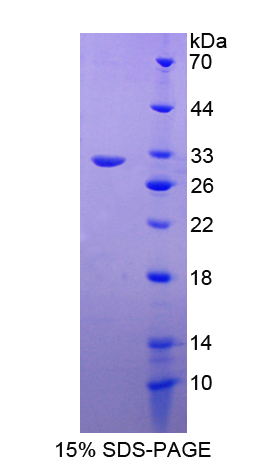 Recombinant Mitogen Activated Protein Kinase Kinase 2 (MAP2K2)
