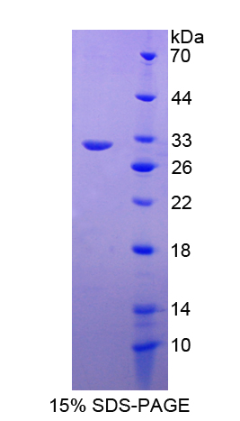 RPD562Hu01.jpg