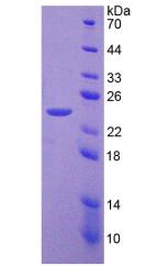 Recombinant Phosphoenolpyruvate Carboxykinase 2, Mitochondrial (PCK2)