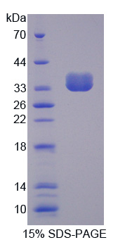 Recombinant Protein Tyrosine Phosphatase, Non Receptor Type 6 (PTPN6)