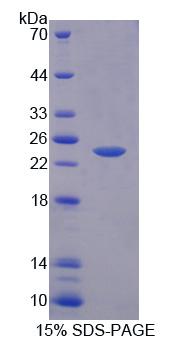 Recombinant Protein Tyrosine Phosphatase Receptor Type A (PTPRA)