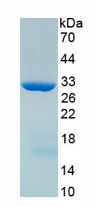 Recombinant ATP Binding Cassette Transporter C3 (ABCC3)