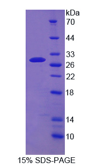 RPD624Hu01.jpg