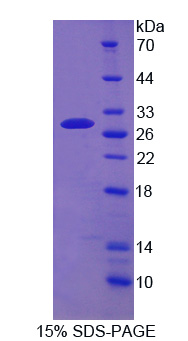 Recombinant ATP Binding Cassette Transporter C4 (ABCC4)