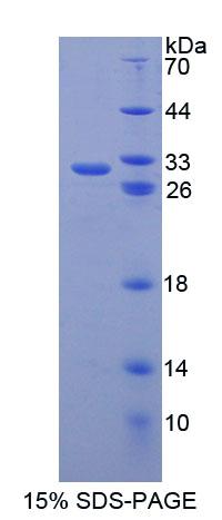 Recombinant ATP Binding Cassette Transporter B6 (ABCB6)