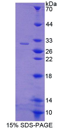 Recombinant ATP Binding Cassette Transporter B8 (ABCB8)