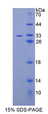 Recombinant ATP Binding Cassette Transporter B9 (ABCB9)