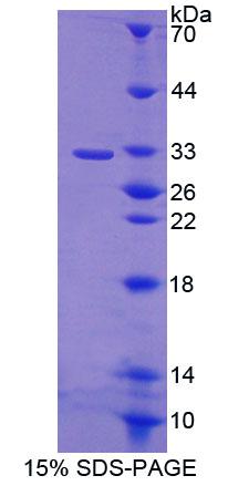 Recombinant ATP Binding Cassette Transporter B9 (ABCB9)