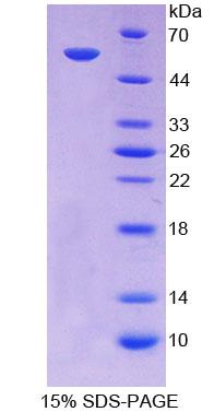 Recombinant ATP Binding Cassette Transporter A13 (ABCA13)