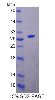 Recombinant Acetyl Coenzyme A Acyltransferase 1 (ACAA1)