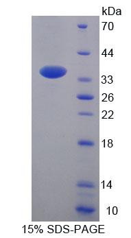 Recombinant Acetyl Coenzyme A Acyltransferase 2 (ACAA2)