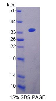 Recombinant Acetyl Coenzyme A Acyltransferase 2 (ACAA2)