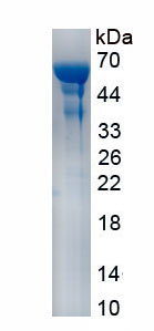 Recombinant Acetyl Coenzyme A Carboxylase Beta (ACACb)