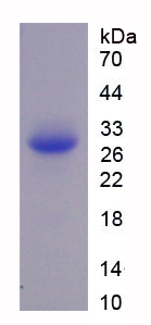 Recombinant Acyl Coenzyme A Dehydrogenase, C4-To-C12 Straight Chain (ACADM)