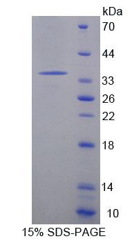 Recombinant Acyl Coenzyme A Dehydrogenase, C4-To-C12 Straight Chain (ACADM)