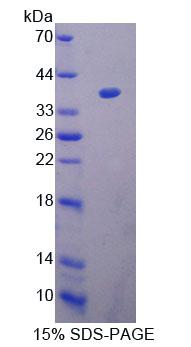 Recombinant Acetyl Coenzyme A Acetyltransferase 1 (ACAT1)