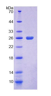 Recombinant Coenzyme A Synthase (COASY)