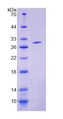 Recombinant Acyl Coenzyme A Synthetase Medium Chain Family, Member 1 (ACSM1)