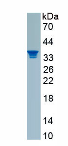 Recombinant Acyl Coenzyme A Synthetase Medium Chain Family, Member 1 (ACSM1)