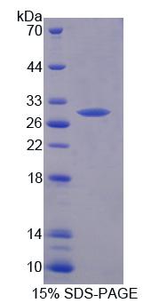 Recombinant Hydroxyacyl Coenzyme A Dehydrogenase (HADH)