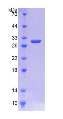 Recombinant 3-Hydroxy-3-Methylglutaryl Coenzyme A Reductase (HMGCR)