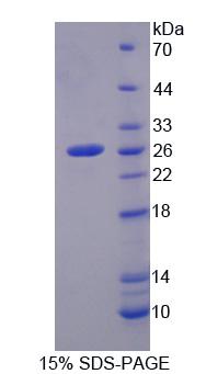 Recombinant Methylcrotonoyl Coenzyme A Carboxylase 2 (MCCC2)