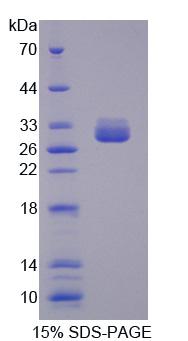 Recombinant Methylmalonyl Coenzyme A Mutase (MUT)