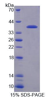 Recombinant Regulator Of G Protein Signaling 9 (RGS9)