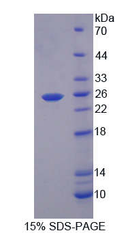 Recombinant Regulator Of G Protein Signaling 5 (RGS5)