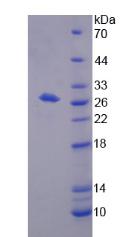 Recombinant Bisphosphoglycerate Mutase (BPGM)