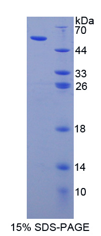 Recombinant Apolipoprotein L (APOL1)