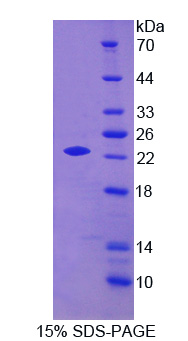 RPD742Hu01.jpg