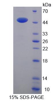 Recombinant Lipolysis Stimulated Lipoprotein Receptor (LSR)