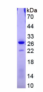 Recombinant Glutathione Synthetase (GSS)