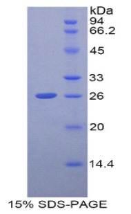 Recombinant Glutamate Cysteine Ligase, Catalytic (GCLC)