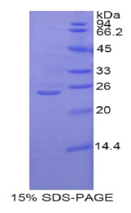 Recombinant Glutamate Cysteine Ligase, Catalytic (GCLC)