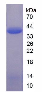 Recombinant Asparagine Synthetase (ASNS)