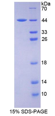 Recombinant Asparagine Synthetase (ASNS)