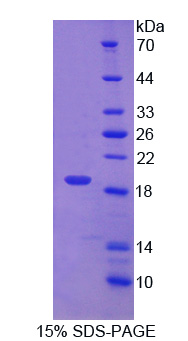 Recombinant Protein Disulfide Isomerase A5 (PDIA5)