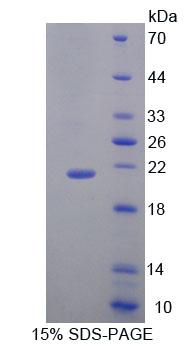 Recombinant Deoxythymidylate Kinase (DTYMK)