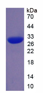 Recombinant Tryptase Beta 2 (TPSb2)