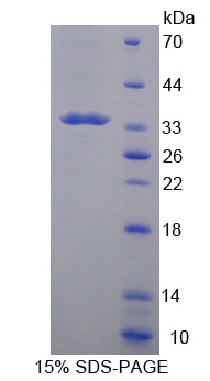 Recombinant Tryptase Beta 2 (TPSb2)