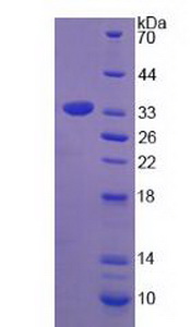 Recombinant Tryptase Beta 2 (TPSb2)