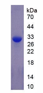 Recombinant Topoisomerase II Beta (TOP2b)