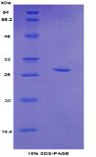 Recombinant Topoisomerase II Beta (TOP2b)