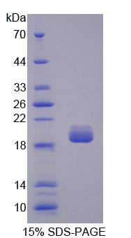 Recombinant Topoisomerase III (TOP3)